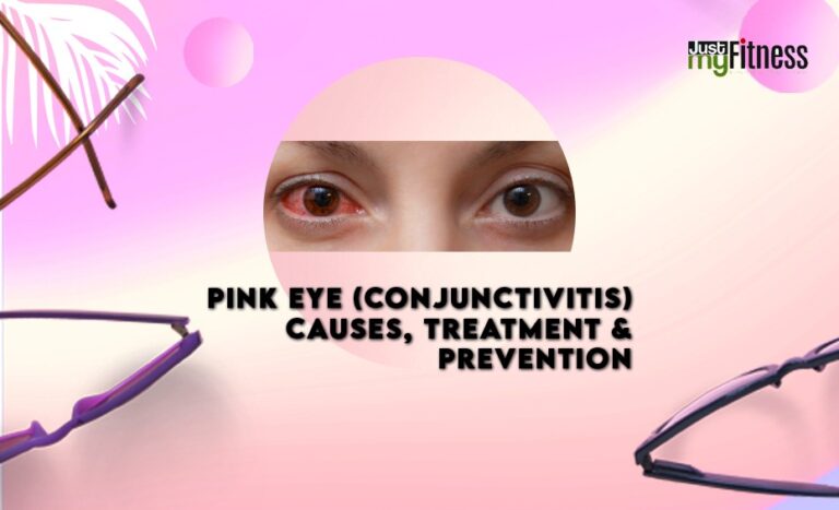 Pink Eye (Conjunctivitis): Causes, Treatment & Prevention