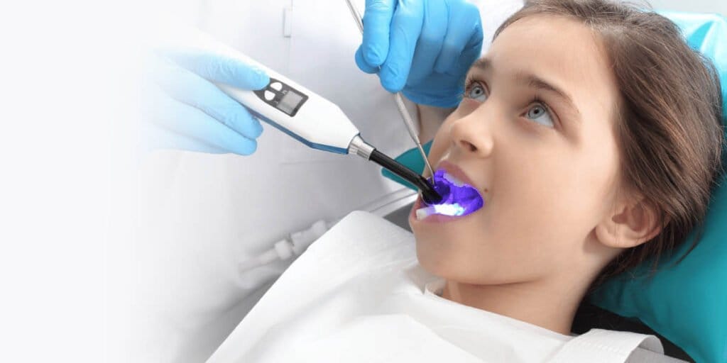 The Role of Dental Sealants in Adult Oral Health