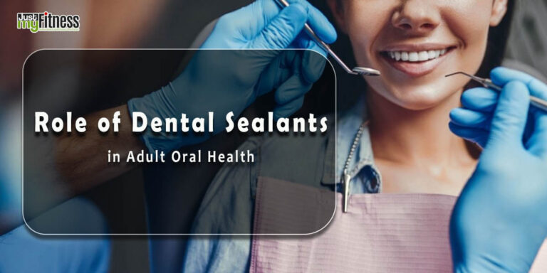 Dental Sealants in Adult Oral Health