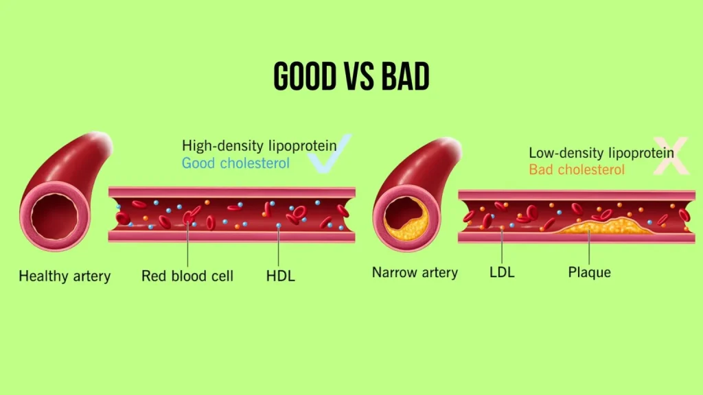 Types of Cholesterol: Good Vs Bad