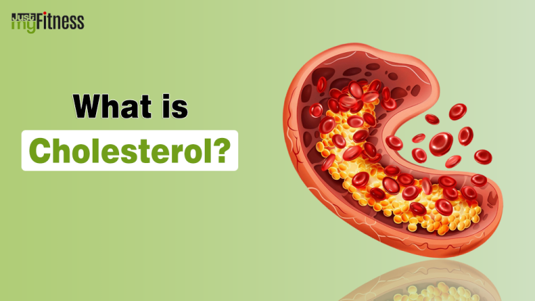 Cholesterol